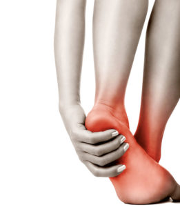 The Correct Stretch and Plantar Fasciitis